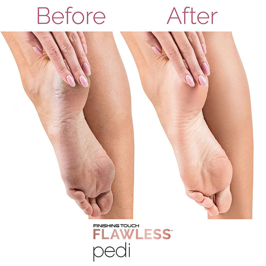 QuickMela.pk™ - Finishing Touch Flawless Pedi Electronic Tool File and Callus Remover, Pedicure