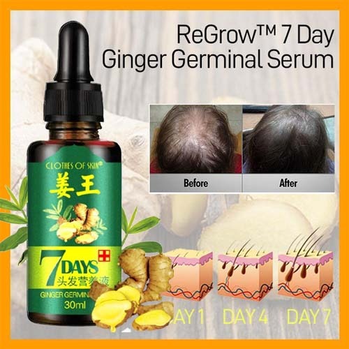 QuickMela.pk™ - Ginger Germinal Oil Hair Nutrient Solution Hair Growth (30ml) - 50% OFF