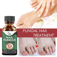 QuickMela.pk™ - Nail Fungi Treatment Serum